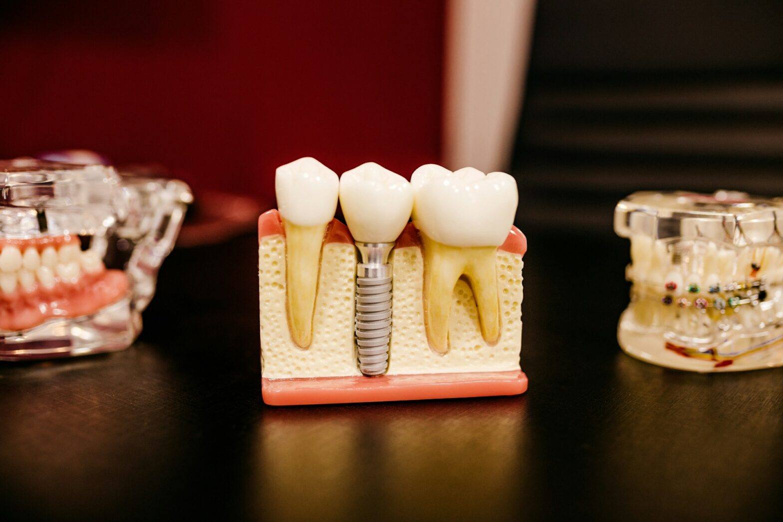 How to Choose a Dental Implant Specialist | Allied Dental